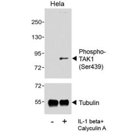 Western blot analysis of lysates from the human HeLa cell line, untreated or treated with IL-1beta (20 ng/ml) + Calyculin A(100 nM), using phospho-TAK1 antibody (upper) or Tubulin Ab (lower).