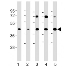 Western blot testing of Glycogenin antibody at 1:2000: Lane 1) human HeLa, 2) human HepG2, 3) mouse heart, 4) mouse skeletal muscle and 5) rat heart lysate. Predicted molecular weight ~39 kDa.
