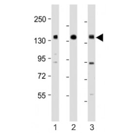 Western blot testing of RON antibody at 1:1000: Lane 1) human HACAT, 2) HCT116 and 3) SK-BR-3 cell lysate. Predicted molecular weight ~152 kDa (beta) and ~185 kDa (alpha/beta heterodimer).