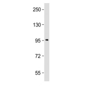 Western blot testing of SSH3 antibody at 1:2000 + ZR-75-1 cell lysate. Predicted molecular weight ~73 kDa, can be observed at 90-95 kDa.