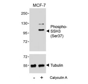 Western blot analysis of lysates from the human MCF7 cell line, untreated or treated with Calyculin A (100nM) using phospho-SSH3 antibody (upper) or Tubulin Ab (lower).