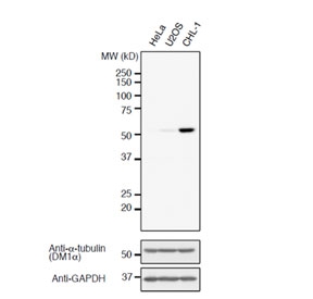 Western blot analysis of human HeLa, U2OS, and CHL-1 cell lysates using Detyrosinated Alpha-Tubulin antibody at a 1:1000 dilution. Image courtesy of Dr. Takashi Hotta from Ohi Lab, University of Michigan, USA.~