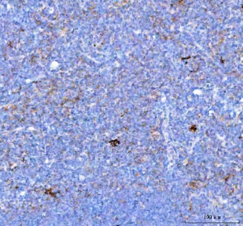 IHC staining of FFPE rat thymus tissue with PD-1 antibody. HIER: boil tissue sections in pH8 EDTA for 20 min and allow to cool before testing.