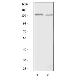 Western blot testing of 1) rat brain and 2) mouse brain tissue lysate with HCN