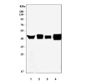 Western blot testing of human 1) HepG2, 2) T-47D, 3) HCCT and 4) HCCP cell lysate with ERLIN2 antibody. Predicted molecular weight ~38 kDa.