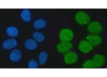 Immunofluorescent staining of FFPE human MCF7 cells with KHSRP antibody (green) and DAPI nuclear stain (blue). HIER: steam section in pH6 citrate buffer for 20 min.