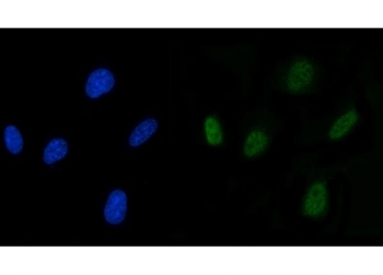 Immunofluorescent staining of FFPE human U-87 MG cells with SLU7 antibody (green) and DAPI nuclear stain (blue). HIER: steam section in pH6 citrate buffer for 20 min.