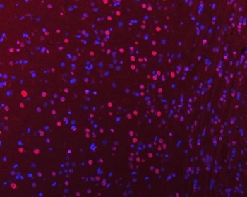 Immunofluorescent staining of FFPE mouse brain tissue with hnRNP U antibody (red) and DAPI nuclear stain (blue). HIER: steam section in pH8 EDTA buffer for 20 min.