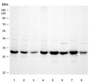 Western blot testing of 1) human RT4, 2) human U-2 OS, 3) human HeLa, 4) human HepG2, 5) rat brain, 6) rat liver, 7) mouse brain and 8) mouse liver tissue lysate with Toll-interacting protein antibody. Expected molecular weight ~30 kDa.