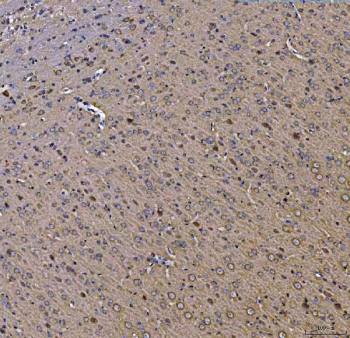 IHC staining of FFPE rat brain tissue with Toll-interacting protein antibody. HIER: boil tissue sections in pH8 EDTA for 20 min and allow to cool before testing.