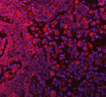 Immunofluorescent staining of FFPE human lung tissue with SELT antibody (red) and DAPI nuclear stain (blue). HIER: steam section in pH8 EDTA buffer for 20 min.