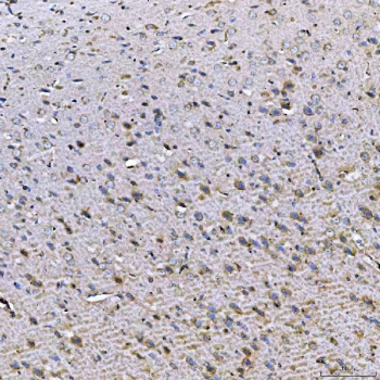 IHC staining of FFPE rat brain tissue with TOM1L1 antibody. HIER: boil tissue sections in pH8 EDTA for 20 min and allow to cool before testing.