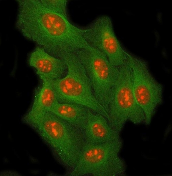 Immunofluorescent staining of FFPE human U-2 OS cells with RRP8 antibody (red) and Beta Tubulin mAb (green). HIER: steam section in pH6 citrate buffer for 20 min.