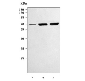 Western blot testing of 1) human MCF7, 2) rat brain and 3) mouse brain tissue lysate with RRP8 antibody. Predicted molecular weight ~51 kDa.