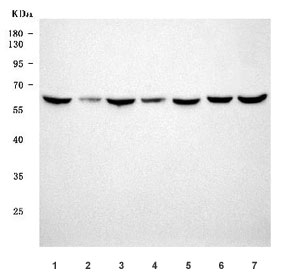 Western blot testing of human 1) MCF7, 2) T-47D, 3) Jurkat, 4) MOLT4, 5) HL60, 6) PC-3 and 7) RT4 cell lysate with SETD3 antibody. Predicted molecular weight ~67 kDa.