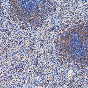 IHC staining of FFPE human spleen tissue with SETD3 antibody. HIER: boil tissue sections in pH8 EDTA for 20 min and allow to cool before testing.