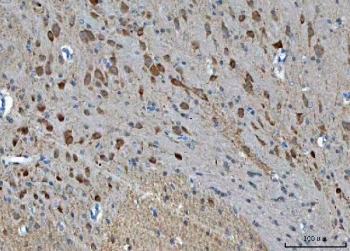 IHC staining of FFPE rat brain tissue with TSR2 antibody. HIER: boil tissue sections in pH8 EDTA for 20 min and allow to cool before testing.