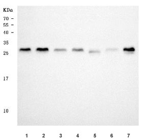 Western blot testing of 1) human HeLa, 2) human 293T, 3) human A549, 4) human MCF7, 5) rat brain, 6) mouse kidney and 7) mouse brain tissue with TSR2 antibody. Predicted molecular weight ~23 kDa, commonly observed at 23-30 kDa.
