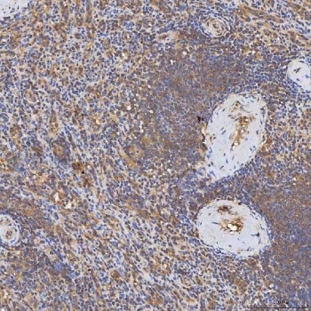 IHC staining of FFPE human spleen tissue with SDCBP2 antibody. HIER: boil tissue sections in pH8 EDTA for 20 min and allow to cool before testing.