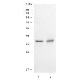 Western blot testing of human 1) A431 and 2) HaCaT cell lysate with SDCBP2 antibody. Predicted molecular weight ~32 kDa, commonly observed at 32-37 kDa with a possible ~23 kDa isoform.