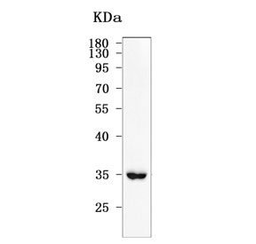 Western blot testing of human MOLT4 cell lysate with RNase H2 subunit B antibody. Predicted molecular weight ~35 kDa.