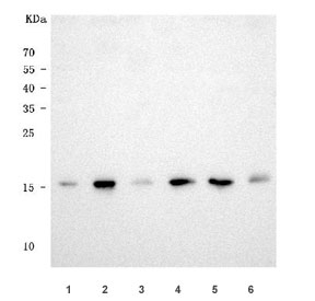 Western blot testing of 1) human HeLa, 2) human HEK293, 3) human SW620, 4) monkey COS-7, 5) rat brain and 6) rat C6 cell lysate with PIN1 antibody. Predicted molecular weight ~18 kDa.