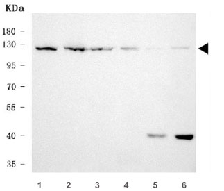 Western blot testing of 1) human HeLa, 2) human MOLT4, 3) human 293T, 4) human A431, 5) rat brain and 6) mouse brain tissue lysate with RNF20 antibody. Predicted molecular weight ~114 kDa.