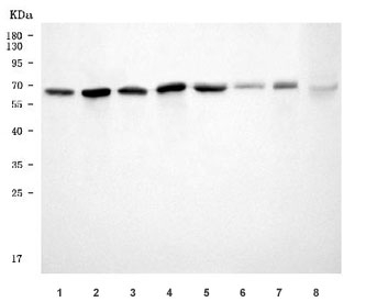 Western blot testing of 1) human PC-3, 2) human 293T, 3) human HeLa, 4) human Jurkat, 5) rat brain, 6) rat PC-12, 7) mouse brain and 8) mouse RAW264.7 cell lysate with hDKIR antibody. Predicted molecular weight ~63 kDa.