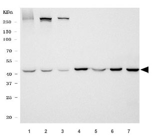 Western blot testing of 1) human T-47D, 2) human HepG2, 3) human Caco-2, 4) rat brain, 5) rat liver, 6) mouse brain and 7) mouse liver tissue lysate with GOT1 antibody. Predicted molecular weight ~41 kDa.