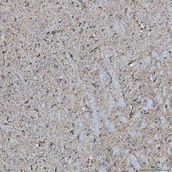 IHC staining of FFPE rat brain tissue with Sideroflexin-5 antibody. HIER: boil tissue sections in pH8 EDTA for 20 min and allow to cool before testing.