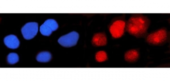 Immunofluorescent staining of FFPE human U-251 cells with IFI16 antibody (red) and DAPI nuclear stain (blue). HIER: steam section in pH6 citrate buffer for 20 min.
