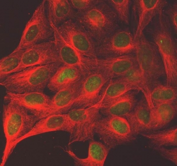 Immunofluorescent staining of FFPE human U-2 OS cells with Shugoshin 2 antibody (green) and Alpha Tubulin mAb (red). HIER: steam section in pH6 citrate buffer for 20 min.