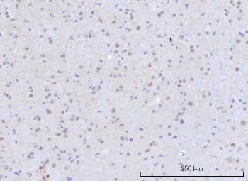 IHC staining of FFPE rat brain tissue with RNA-binding protein 22 antibody. HIER: boil tissue sections in pH8 EDTA for 20 min and allow to cool before testing.