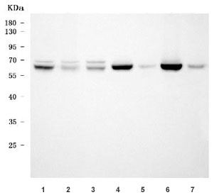 Western blot testing of 1) human HeLa, 2) human 293T, 3) human MCF7, 4) rat brain, 5) rat pancreas, 6) mouse brain and 7) mouse pancreas tissue lysate with AHCYL1 antibody. Predicted molecular weight ~59 kDa.