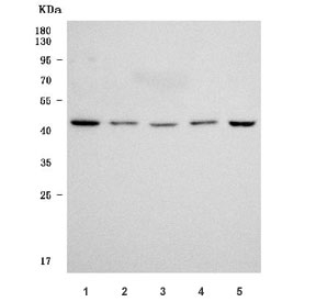Western blot testing of 1) human K562, 2) human 293T, 3) human Jurkat, 4) rat testis and 5) mouse testis tissue lysate with Endophilin-A3 antibody. Predicted molecular weight ~39 kDa.