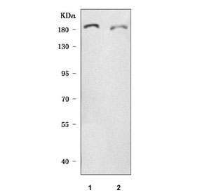 Western blot testing of human 1) Caco-2 and 2) MCF7 cell lysate with SHROOM2 antibody. Predicted molecular weight ~176 kDa.