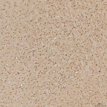 IHC staining of FFPE rat brain tissue with FAM60A antibody. HIER: boil tissue sections in pH8 EDTA for 20 min and allow to cool before testing.