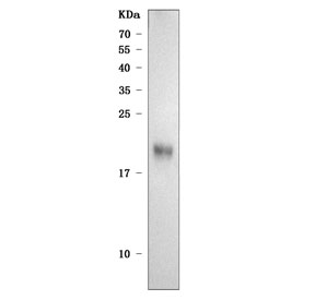 Western blot testing of human MOLT4 cell lysate with SIVA1 antibody. Predicted molecular weight ~19 kDa.
