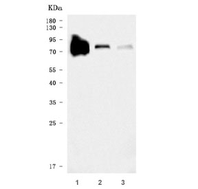 Western blot testing of 1) human HCCP, 2) rat liver and 3) mouse liver tissue lysate with Transferrin antibody. Predicted molecular weight ~77 kDa.