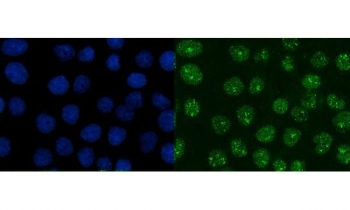Immunofluorescent staining of FFPE human A431 cells with XRCC1 antibody (green) and DAPI nuclear stain (blue). HIER: steam section in pH6 citrate buffer for 20 min.