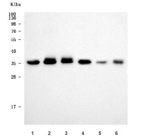 Western blot testing of 1) human Jurkat, 2) human 293T, 3) monkey COS-7, 4) human ThP-1, 5) rat NRK and 6) mouse HBZY cell lysate with HP59 antibody. Predicted molecular weight ~55 kDa and 31 kDa (two isoform) which may be observed at higher molecular weights due to glycosylation.