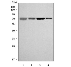 Western blot testing of 1) human plasma, 2) rat liver, 3) mouse spleen and 4) mouse liver tissue lysate with Ferroportin 1 antibody. Predicted molecular weight: ~62 kDa, but may be observed at higher molecular weights due to glycosylation.