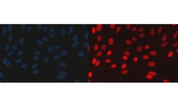 Immunofluorescent staining of FFPE human U-2 OS cells with BAF57 antibody (red) and DAPI nuclear stain (blue). HIER: steam section in pH6 citrate buffer for 20 min.