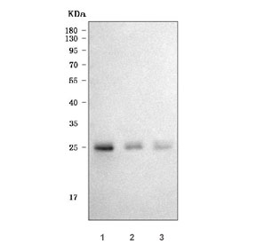 Western blot testing of human 1) SiHa, 2) U-87 MG and 3) A549 cell lysate with Thymidine Kinase 2 antibody. Predicted molecular weight: 20-35 kDa (multiple isoforms).