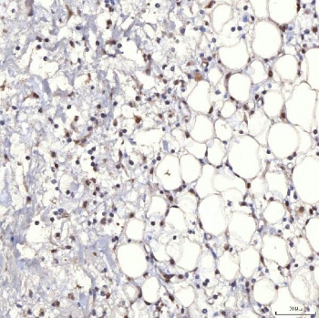 IHC staining of FFPE rat skin tissue with TRMT61A antibody. HIER: boil tissue sections in pH8 EDTA for 20 min and allow to cool before testing.