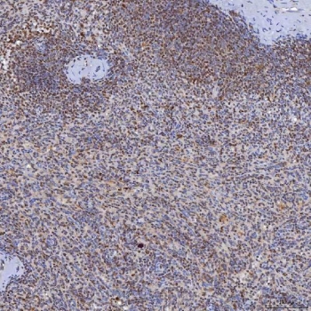 IHC staining of FFPE human spleen tissue with TRMT61A antibody. HIER: boil tissue sections in pH8 EDTA for 20 min and allow to cool before testing.