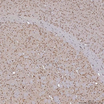 IHC staining of FFPE mouse brain tissue with TRMT61A antibody. HIER: boil tissue sections in pH8 EDTA for 20 min and allow to cool before testing.