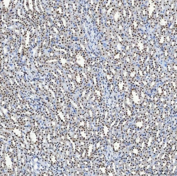 IHC staining of FFPE rat kidney tissue with SAP130 antibody. HIER: boil tissue sections in pH8 EDTA for 20 min and allow to cool before testing.
