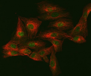 Immunofluorescent staining of FFPE human U-2 OS cells with mSin3A antibody (green) and Alpha Tubulin mAb (red). HIER: steam section in pH6 citrate buffer for 20 min.
