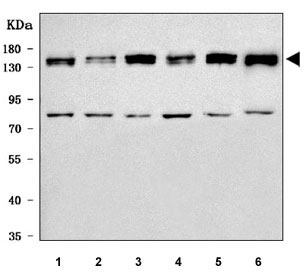 Western blot testing of 1) human HeLa, 2) human Jurkat, 3) human 293T, 4) human K562, 5) human MCF7 and 6) rat PC-12 cell lysate with mSin3A antibody. Predicted molecular weight ~145 kDa.